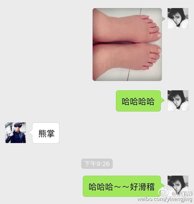 伊能靜臨產(chǎn)腳腫肚子過敏 伊能靜臨產(chǎn)腳腫肚子過敏