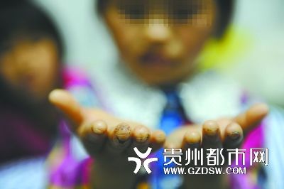指尖被針扎得傷痕累累。