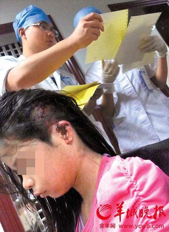受傷的11歲女孩頭發(fā)被卷入扶梯，耳朵被嚴(yán)重拉傷，需手術(shù)。