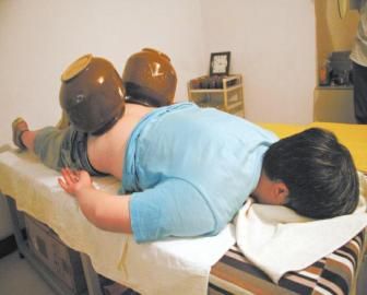 拔泡菜壇子火罐。