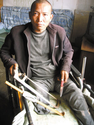 鄭艷良就是用這幾樣簡陋工具，給自己做了右腿截肢手術。