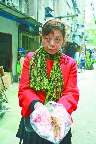 頭部受傷的黃女士展示兩根大魚刺。