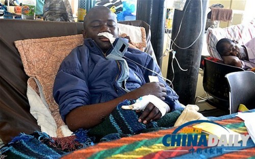 雖然已經(jīng)在醫(yī)院接受了近一個(gè)月的恢復(fù)治療，卡托卡的身體仍然非常虛弱。