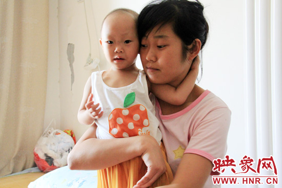孩子和媽媽在一起，她的右眼已經失明。