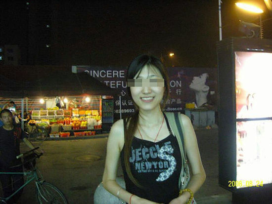 女海歸上海削骨整形 疑因術后出血誘發(fā)癲癇