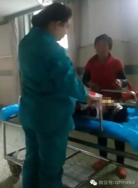涵涵爸爸告訴《每日新聞》記者：“沒想到是熱水，大人也沒看，一時疏忽，掉進(jìn)去了。抱出來的時候這個皮已經(jīng)掉了。”