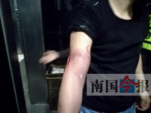 覃先生手臂被卡的部位受傷流血，所幸傷勢(shì)無(wú)大礙。 通訊員 王建民 攝