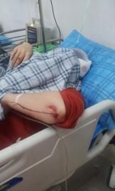 砸窗當(dāng)事人胡女士在醫(yī)院接受治療。