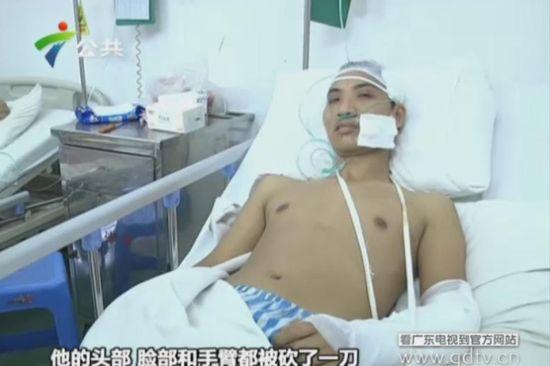 另一名傷者頭部、臉部和手臂都被砍了一刀。(視頻截圖)