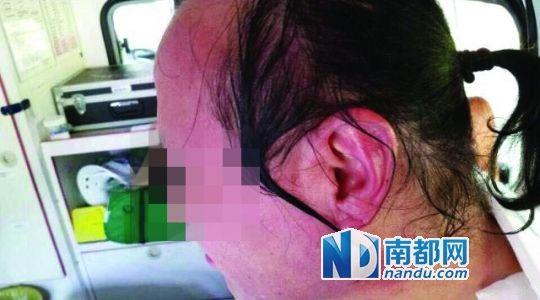 涉事教師遭熱水潑臉后的照片。