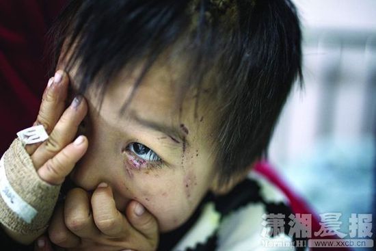 1月13日，湖南省兒童醫(yī)院，4歲的源源用手蒙住了眼睛。
