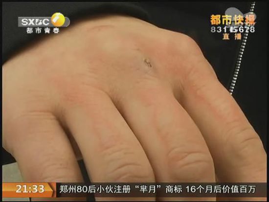說到這足療拔罐，估計大伙都不陌生，但是想起4號晚上的拔罐的經(jīng)歷，呂先生現(xiàn)在想起來，還心有余悸。