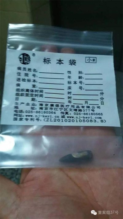 經(jīng)警方鑒定，秦女士體內(nèi)取出的子彈系56式步槍射出 。 受訪者供圖