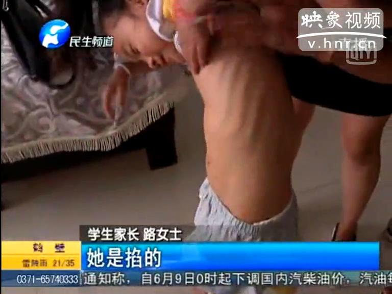 幼兒不睡覺(jué) 老師竟要求其脫衣服體罰